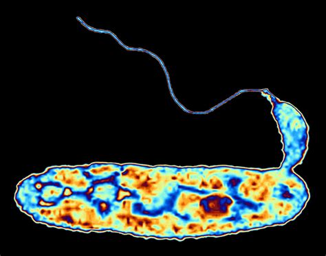  Xanthamoeba! An Enigmatic Amoeba that Devours Bacteria for Breakfast