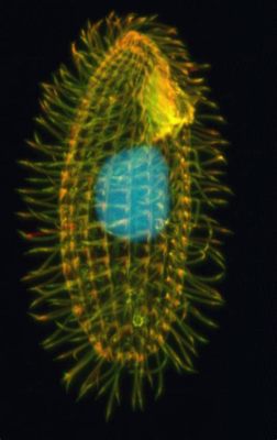  Tetrahymena! A Single-Celled Wonder That Eats Like It’s Got Twenty-Four Stomachs