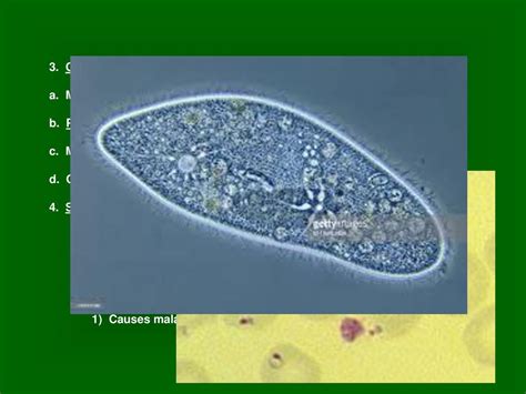  Zoothamnium: This Tiny Ciliate With Its Hair-Like Cilia Is A Master Of Aquatic Ballet!