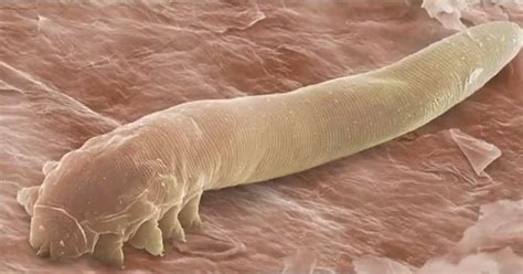  Eyelash Worm: This Microscopic Marvel Embraces Asexual Reproduction Through Fission!